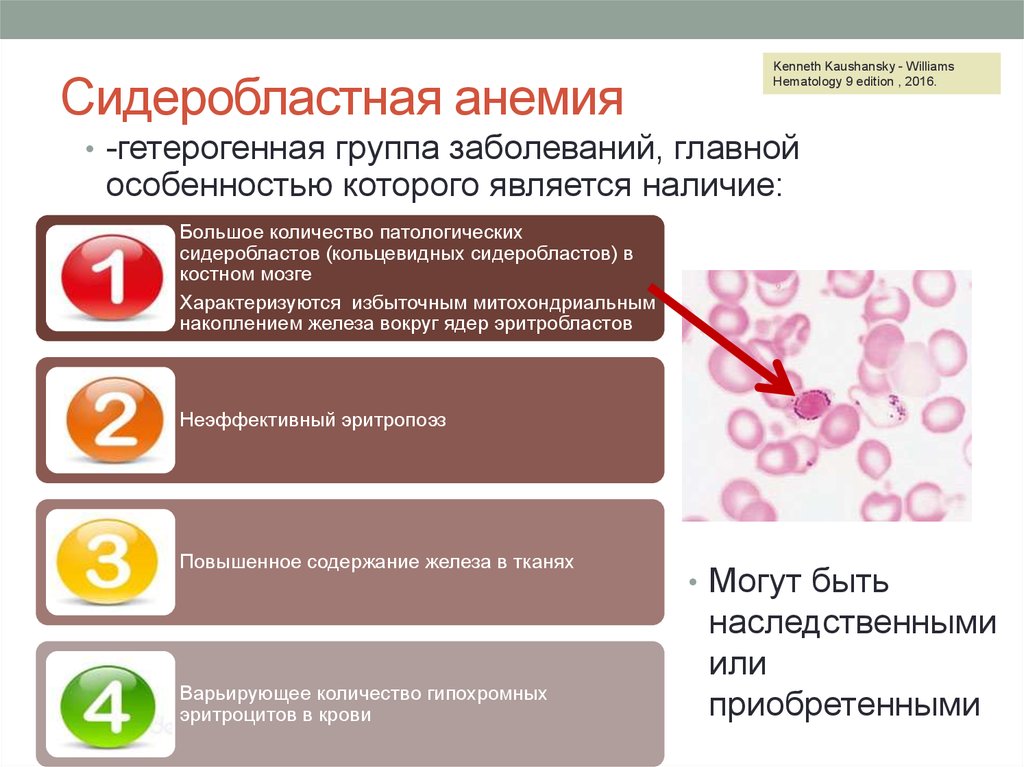 Сидеробластная анемия презентация