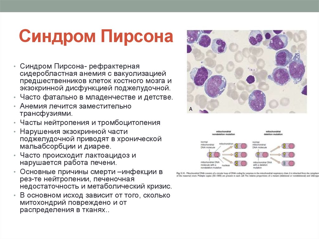 Сидеробластная анемия презентация