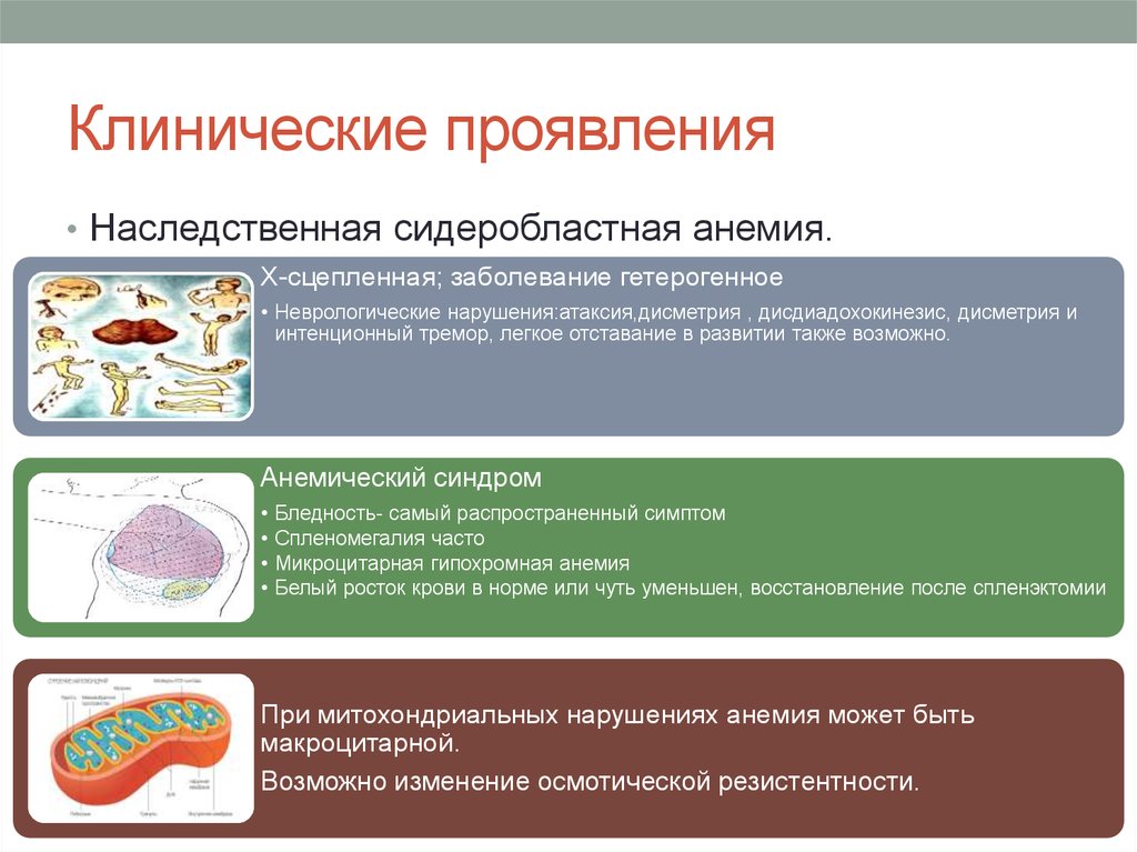 Анемия клинические рекомендации. Сидеробластная анемия клинические рекомендации. Сидеробластная анемия гипохромная. Сидероахрестическая анемия симптомы. Симптомы сидеробластной анемии.