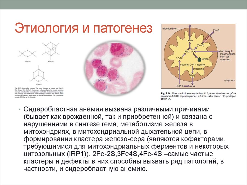 Сидероахрестические анемии причины механизмы развития клиника картина крови