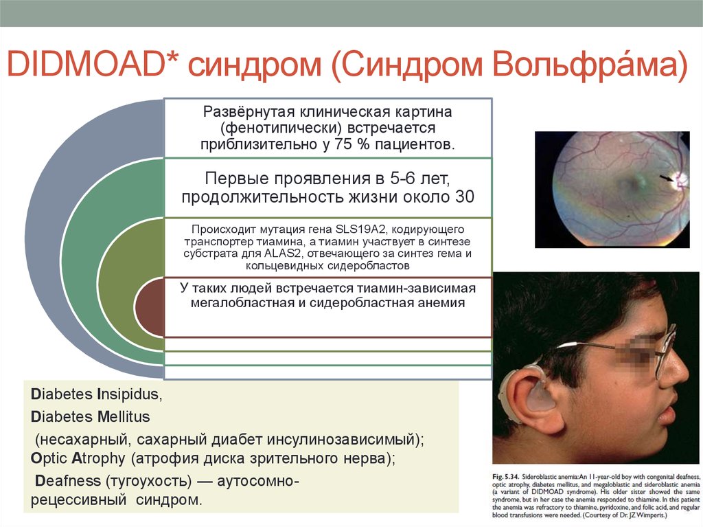 Синдром пирсона презентация