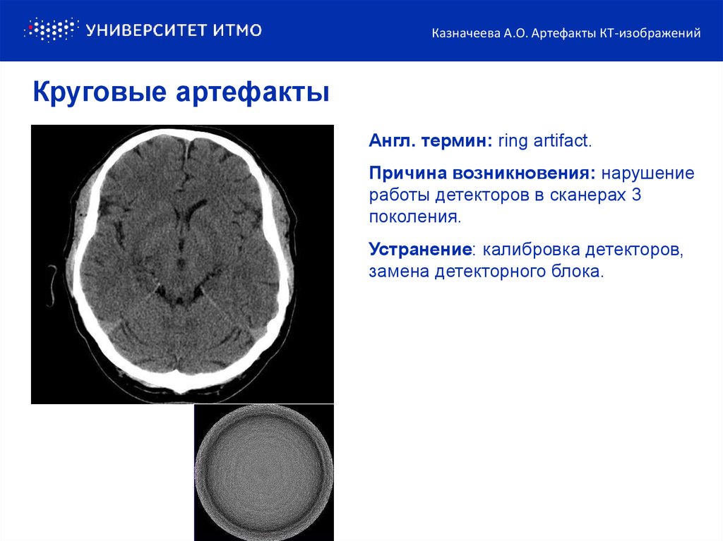 Артефакты мрт презентация