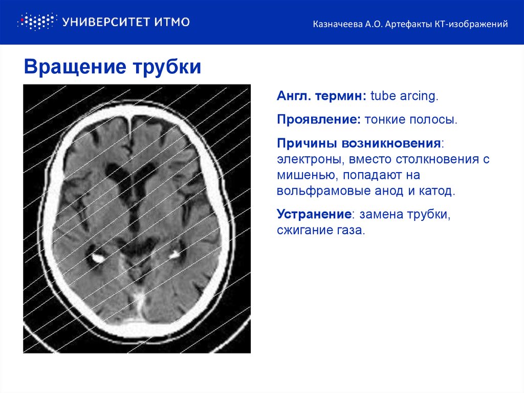 Артефакты мрт презентация