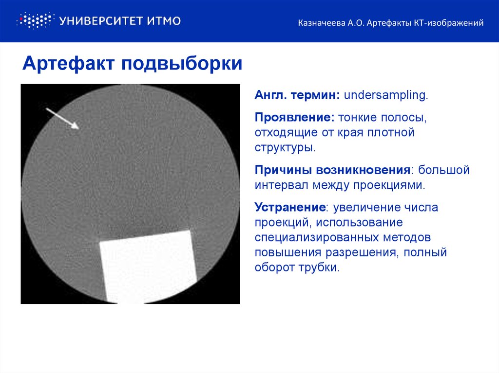 Итеративная реконструкция кт изображений