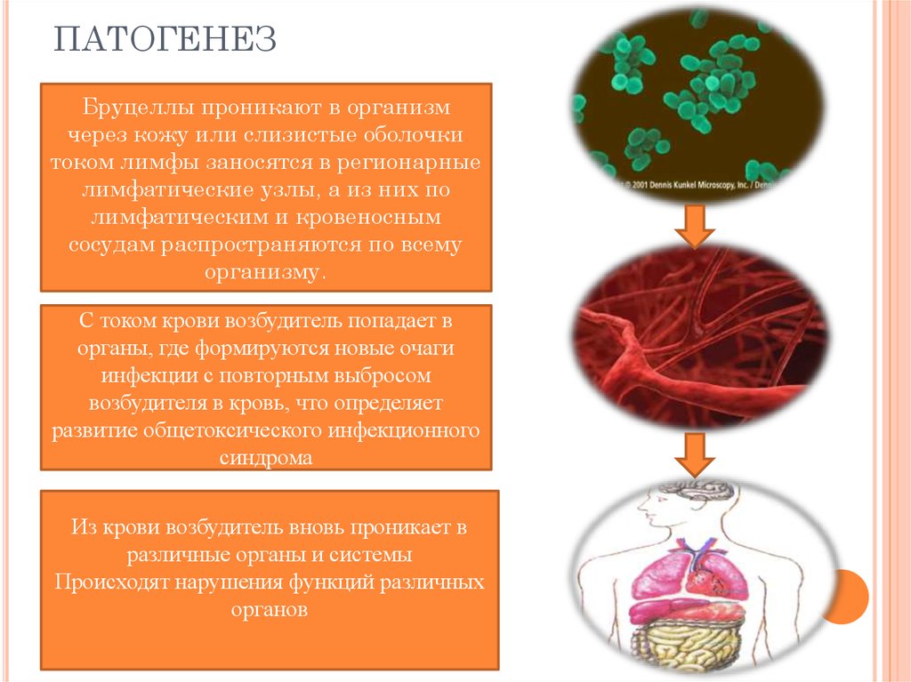 Патогенез псевдотуберкулеза схема