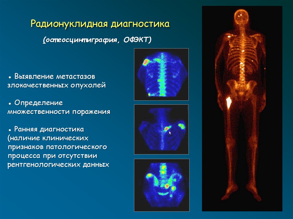 Лучевая диагностика нервной системы презентация