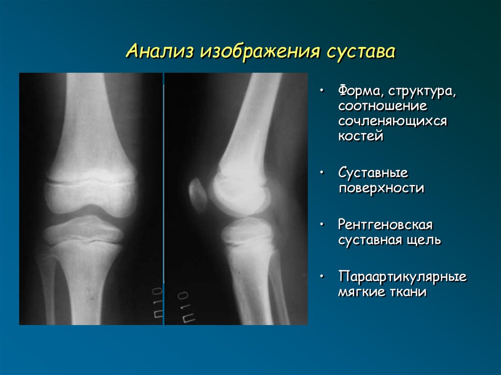 Лучевая диагностика опорно двигательной системы презентация