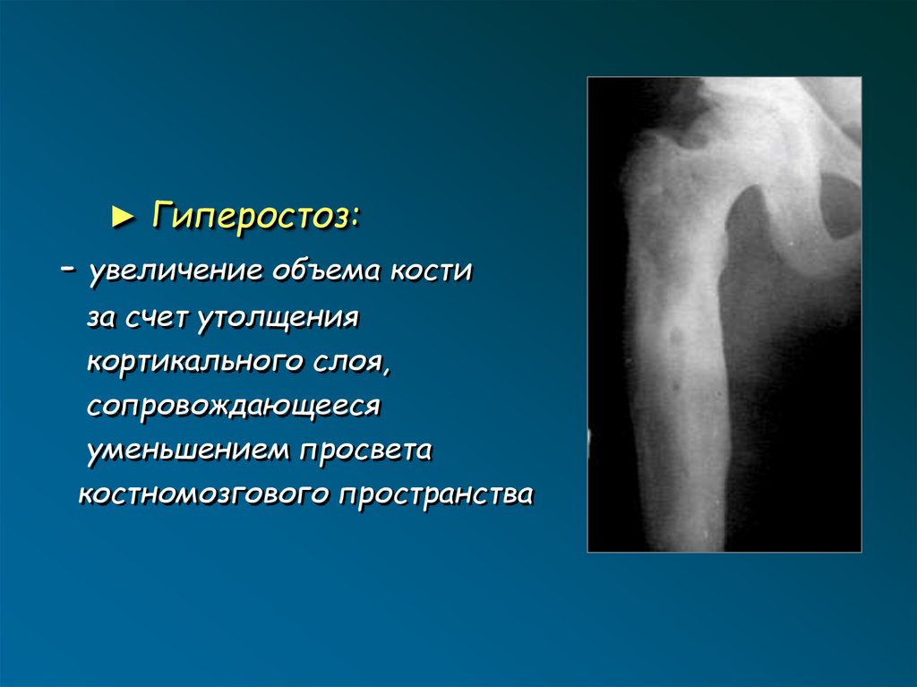 Лучевая диагностика опорно двигательной системы презентация