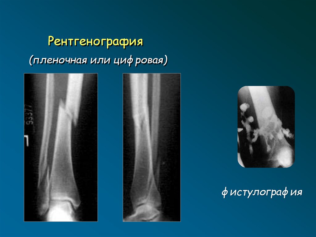 Лучевая диагностика опорно двигательной системы презентация