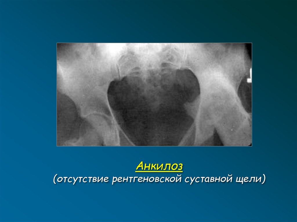 Лучевая диагностика опорно двигательной системы презентация