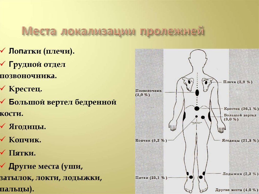 Статистика пролежней. Места локализации пролежней. Места образования пролежней. Механизм образования пролежней. Места образования пролежней картинки.