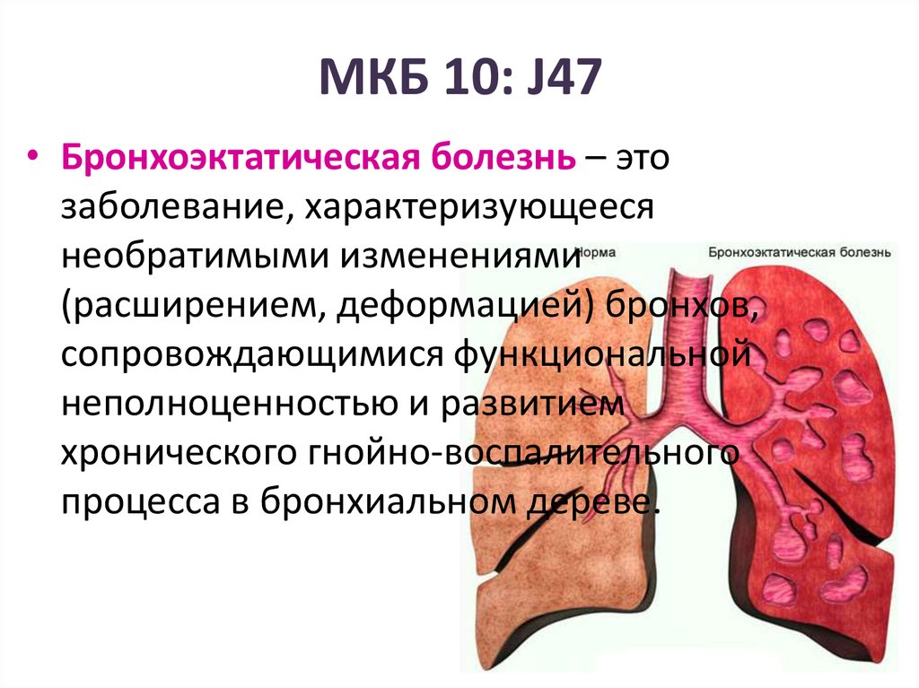 Недостаточность клапанов мкб 10