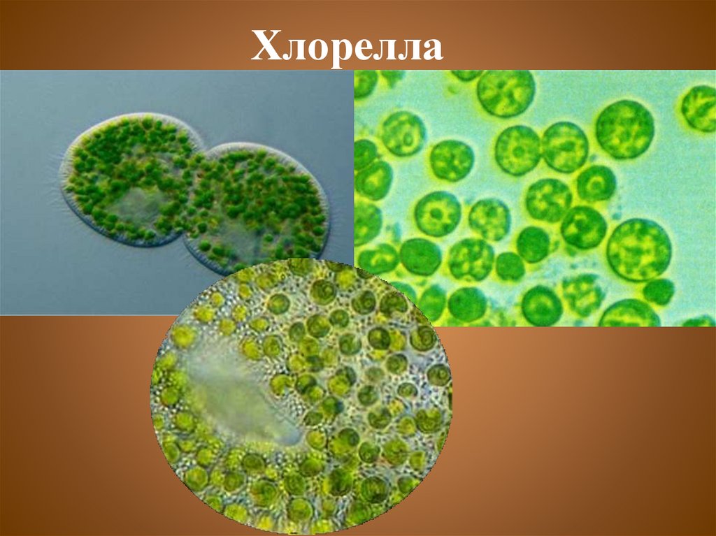 Хлорелла относится к водорослям. Одноклеточная водоросль хлорелла. Хлорелла Фототроф. Хлорелла микроскоп. Хлорелла мембрана.