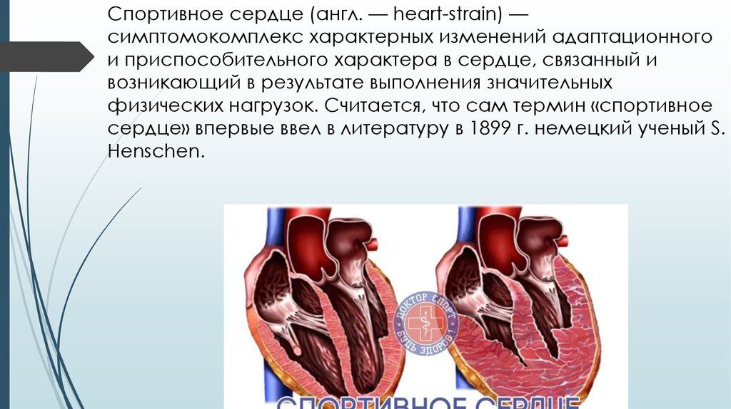 Сердцем отличай. Спортивное сердце. Спортивное сердце симптомы. Спортивное сердце гипертрофия миокарда. Особенности спортивного сердца.