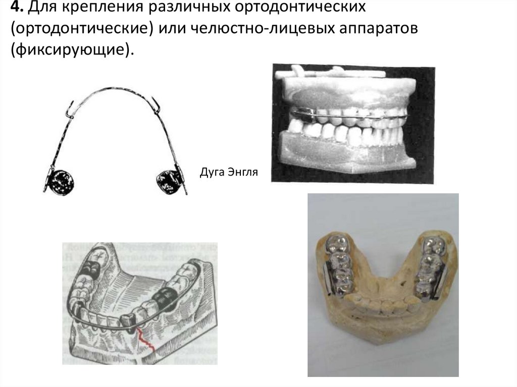 Классификация челюстно лицевых и лицевых протезов презентация