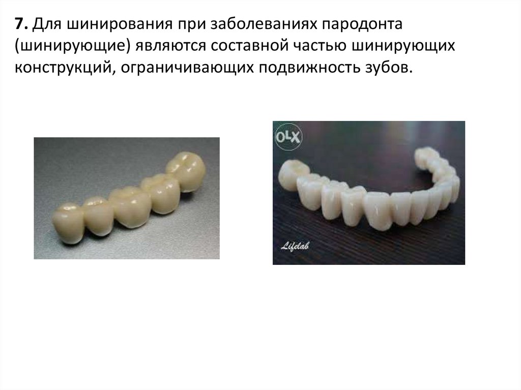 Временные коронки презентация