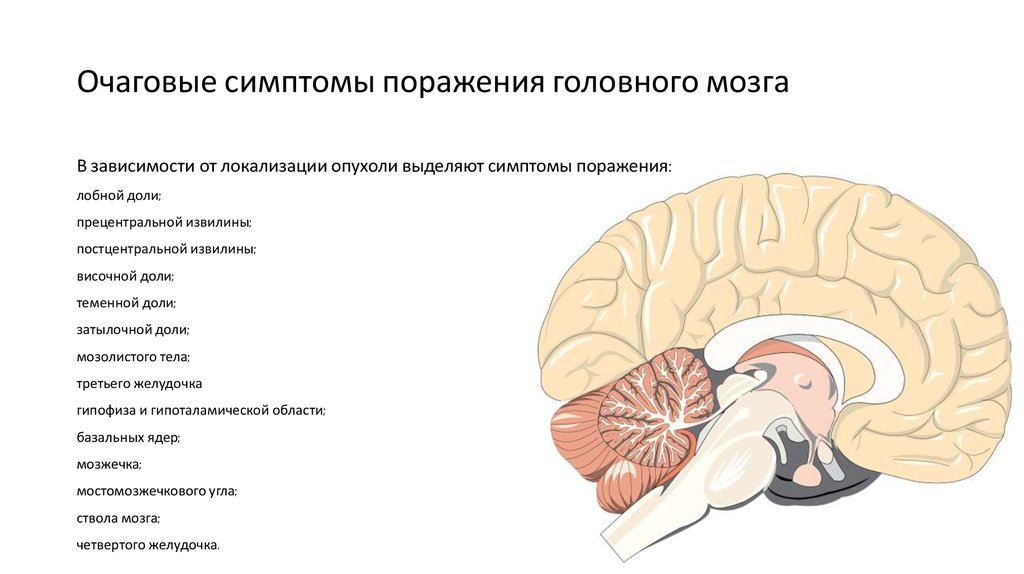 Опухоль головного мозга первый симптом. Очаговая симптоматика опухолей головного мозга. Очаговые симптомы опухолей головного мозга. Очаговые симптомы поражения головного мозга. Опухоль мозолистого тела.
