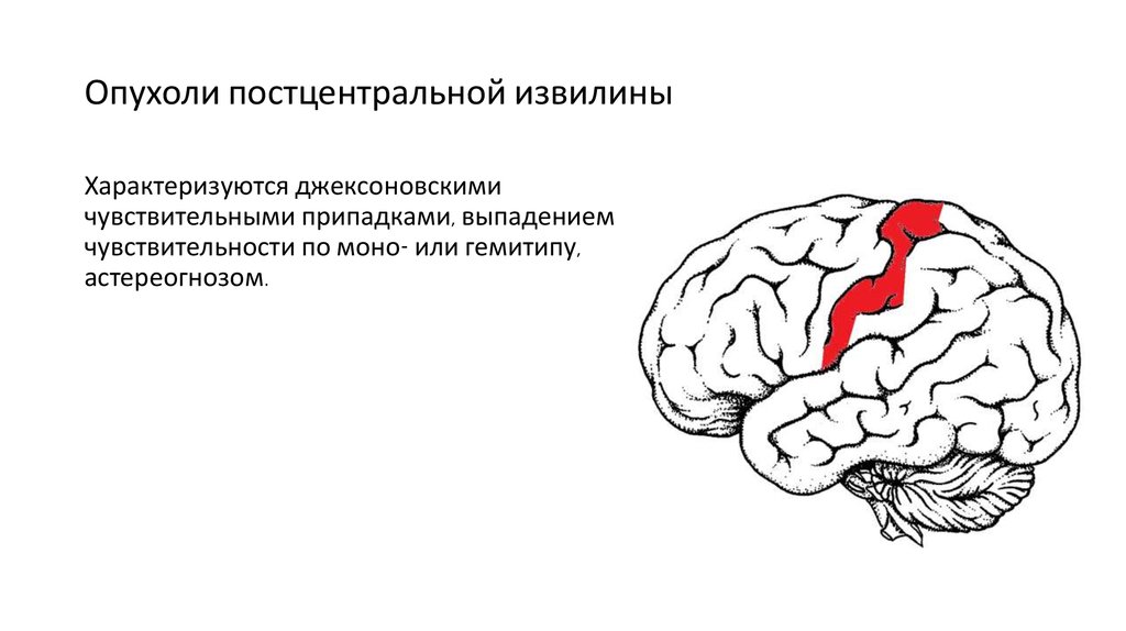 Центральная извилина мозга. Опухоли постцентральной извилины. Нижние отделы постцентральной извилины. Задней центральной извилины коры большого мозга..