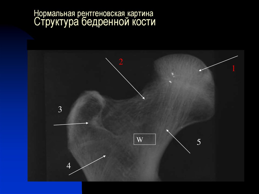 Келлера 1 рентген картина