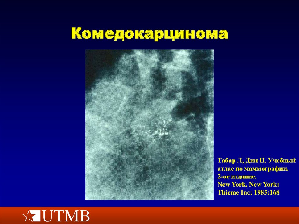 Заболевания молочной железы презентация