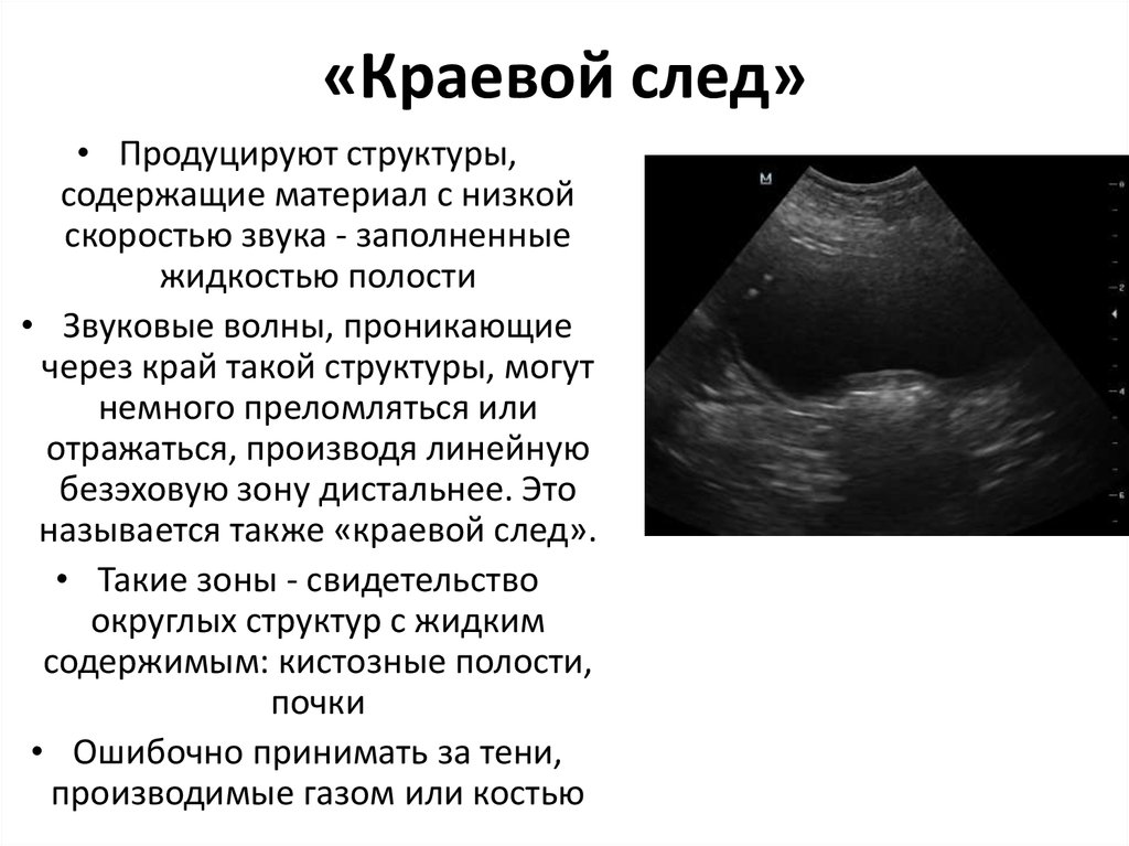 «Краевой след»