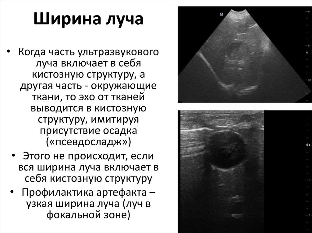 Ширина луча