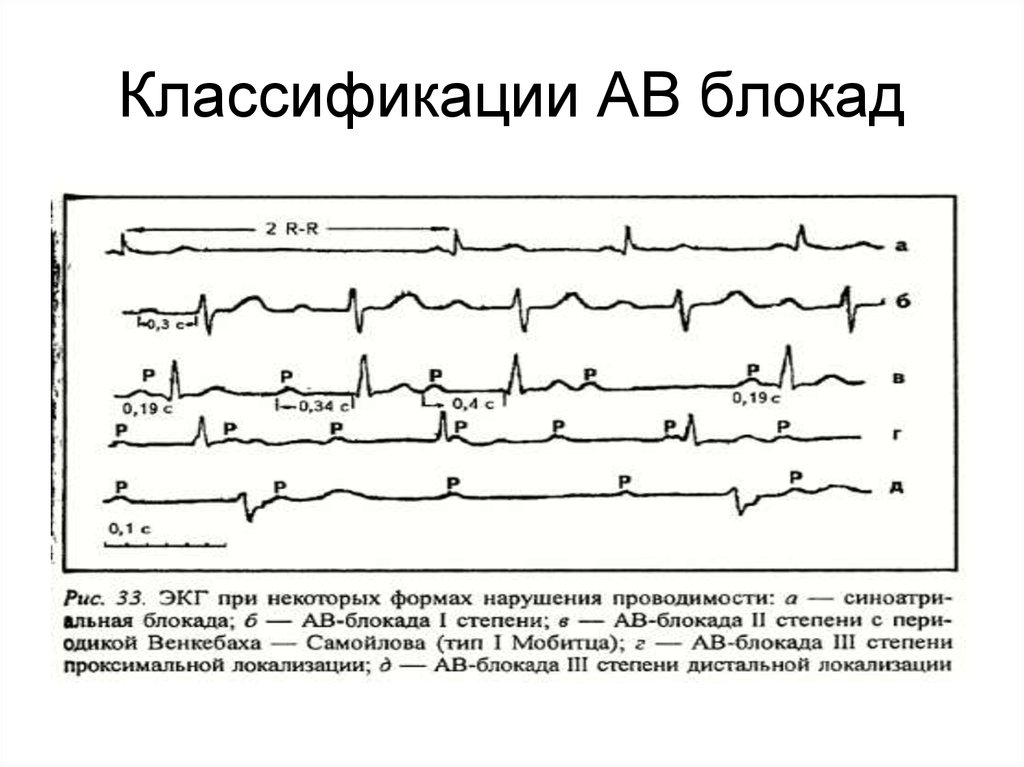 Карта вызова блокада