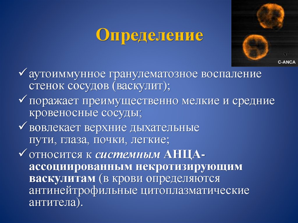 Хронический гранулематоз. Гранулематоз Вегенера презентация. Гранулематоз Вегенера сыпь. Бронхоцентрический гранулематоз. Гранулематоз Вегенера дифференциальная диагностика.