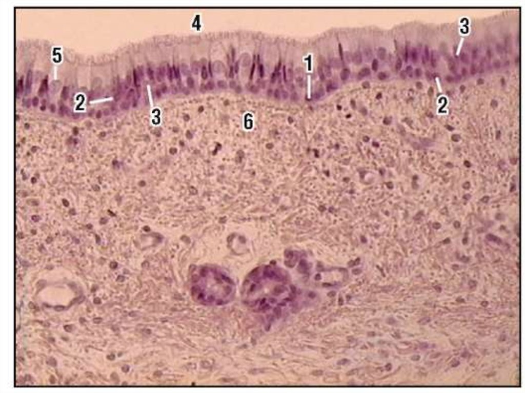 Трахею выстилает эпителий. Однослойный плоский эпителий гистология. Мерцательный эпителий гистология препарат. Реснитчатый эпителий гистология. Многорядный призматический мерцательный эпителий трахеи.