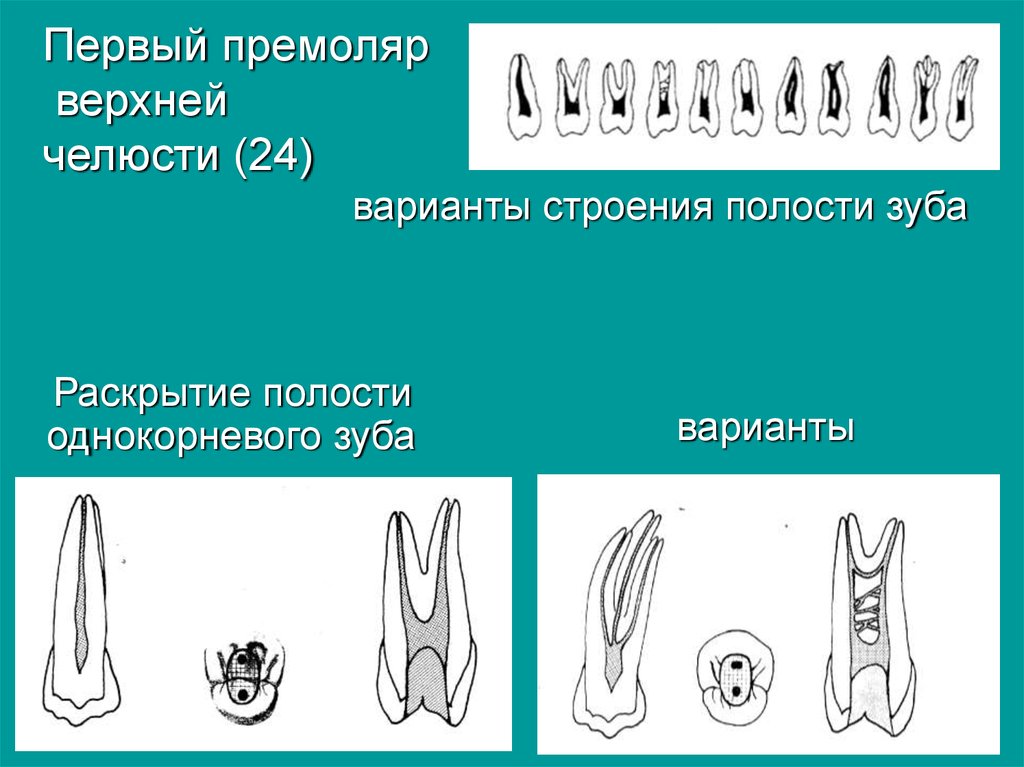 Премоляры и моляры предназначены для у млекопитающих. Зуб 1 премоляр верхней челюсти. Премоляры верхней челюсти эндодонтия. Анатомия 1 премоляра верхней челюсти. Первый премоляр верхней челюсти анатомия.