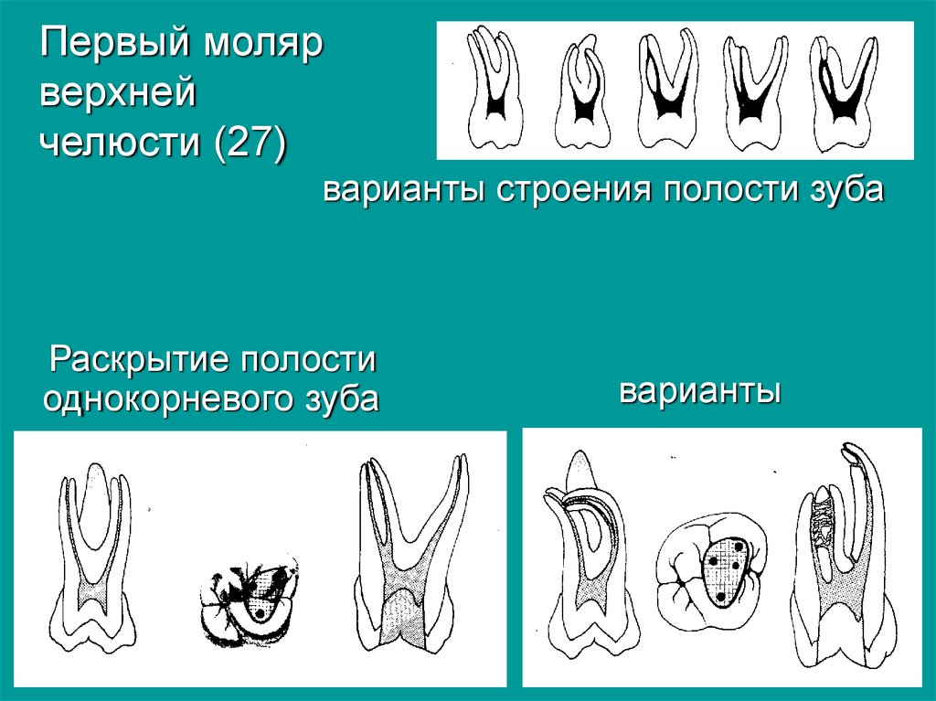 Первый верхний 2. Корневые каналы 1 моляра верхней челюсти. Морфология первого моляра верхней челюсти. Первый моляр верхней челюсти анатомия.