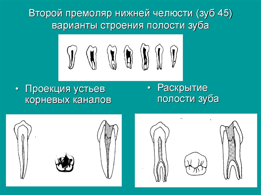 Премоляры и моляры предназначены для у млекопитающих. Второй премоляр нижней челюсти анатомия корневых каналов. Анатомия зубов нижней челюсти премоляр. Второй премоляр нижней челюсти на челюсти. Второй премоляр нижней челюсти эндодонтия.