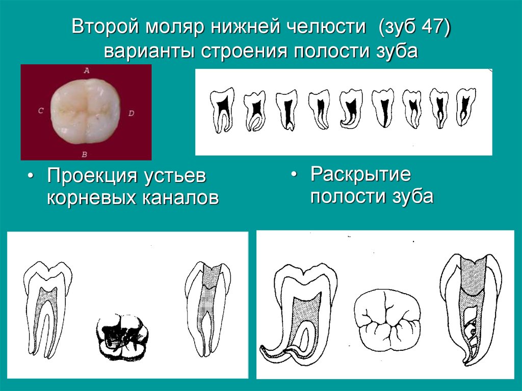 Коренные зубы вторым. Второй моляр нижней челюсти анатомия зуба. Анатомия зуба моляра нижней челюсти. Второй моляр нижней челюсти анатомия корневых каналов. 2 Моляр нижней челюсти анатомия.