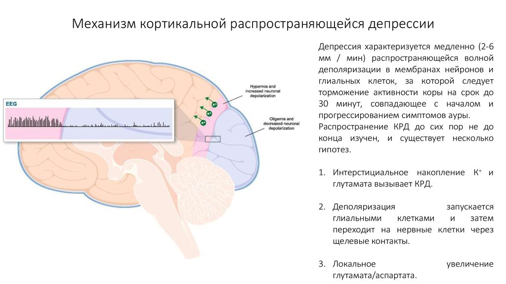 Карта депрессии. Распространение корковой депрессии Leo. Патогенез депрессии. Головной мозг при депрессии. Патогенез мигрени.