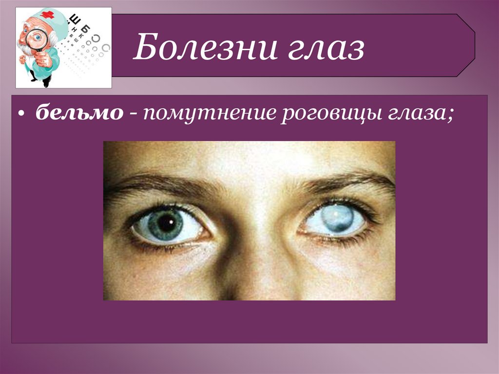 Заболевания органа глаза. Симптомы заболевания глаз. Перечень заболеваний глаз.
