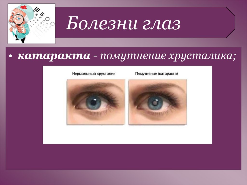 Гигиена зрения предупреждение глазных. Заболевания глаз список. Болезни зрения у человека список. Заболевание глаз у человека список.
