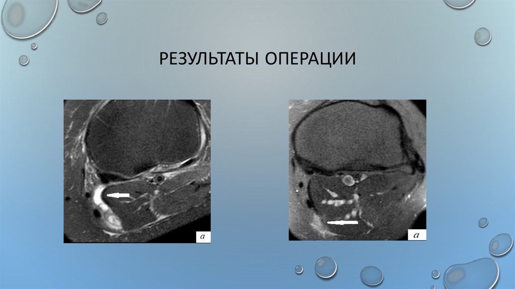 Результаты операции