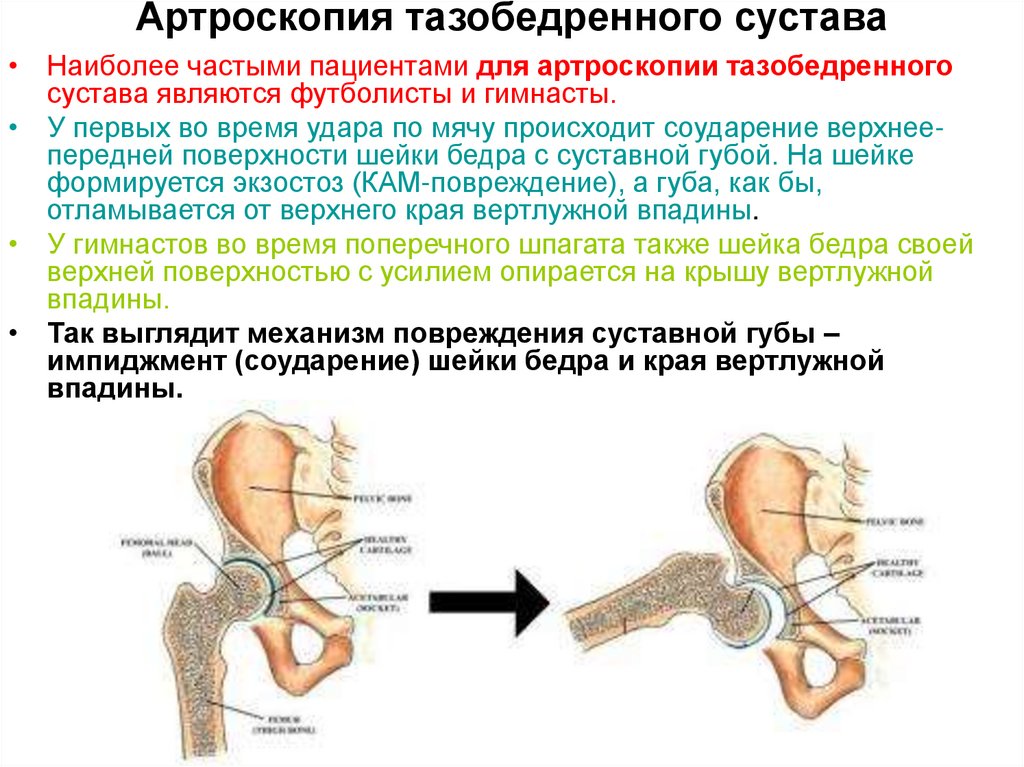 Операция тазобедренного сустава 1 степени. Тазобедренный сустав. Тазобедренный сустав суставы. Строение тазобедренного сустава. Правый тазобедренный сустав.