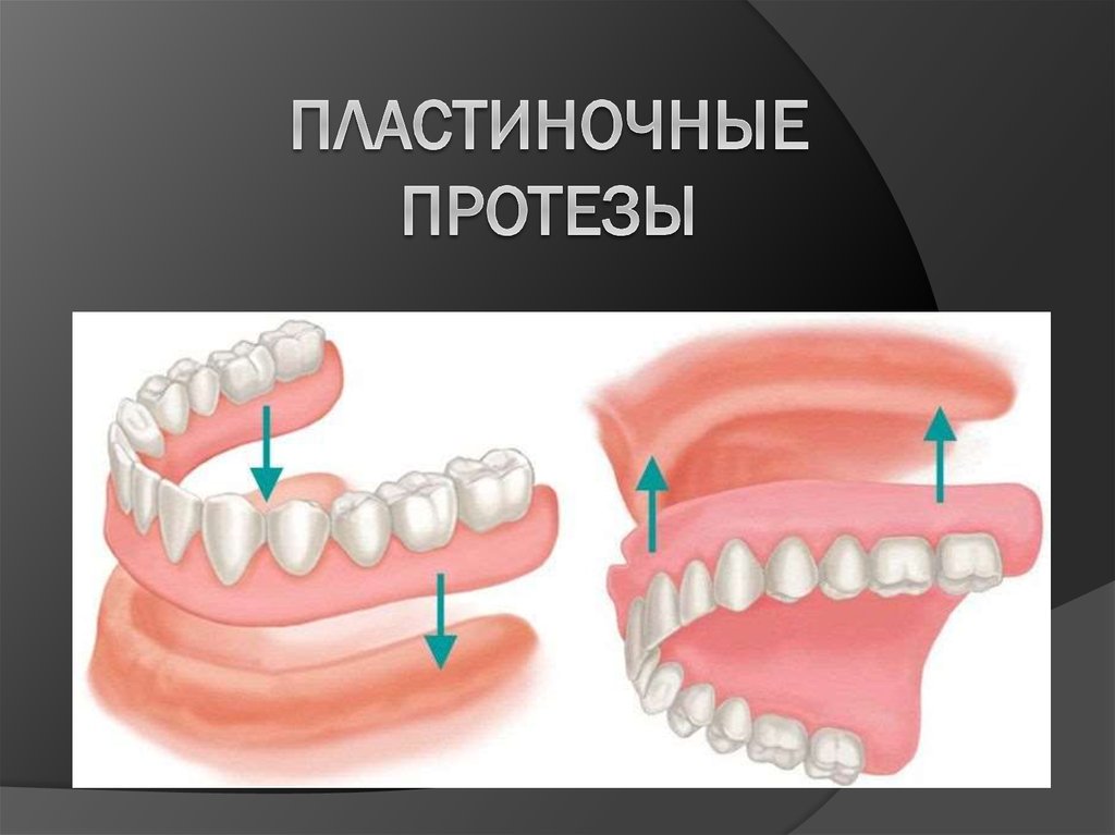 Полный съемный протез презентация