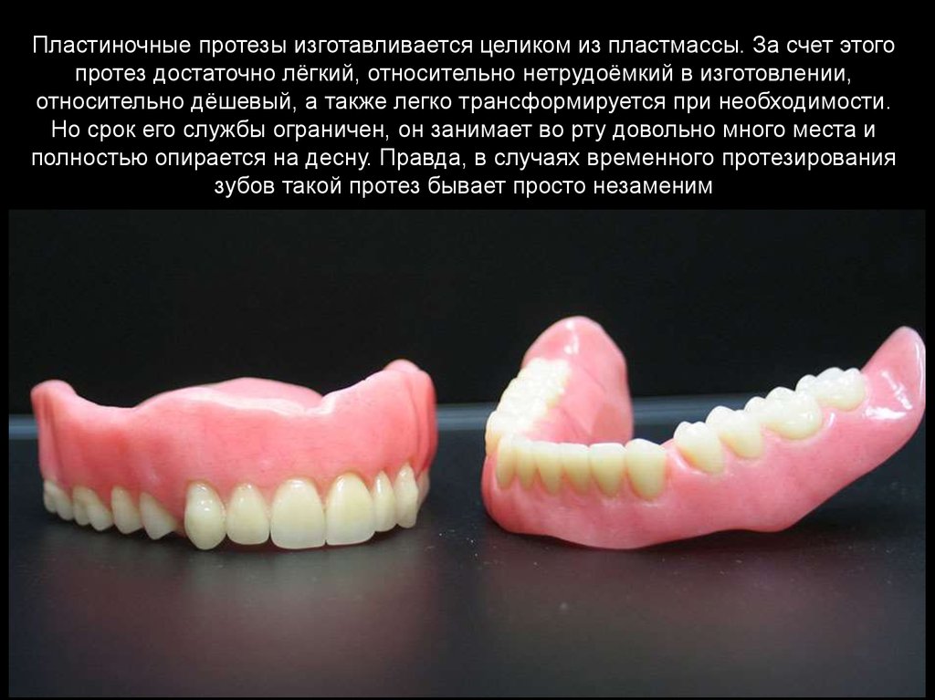 Пластиночные протезы презентация