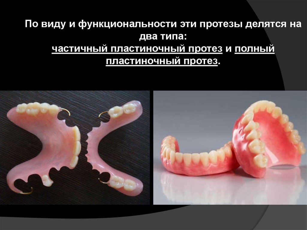 Пластиночные протезы презентация