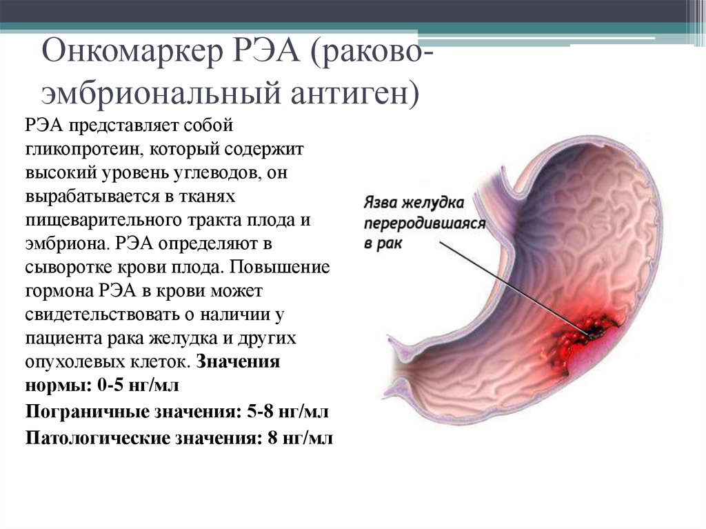 Исследование рэа. Раково-эмбриональный антиген (РЭА). Cea Раково эмбриональный антиген норма. Эмбриональные антигены. РЭА онкомаркер.