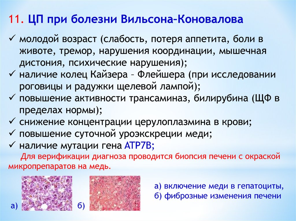 Пример диагноза цирроза печени