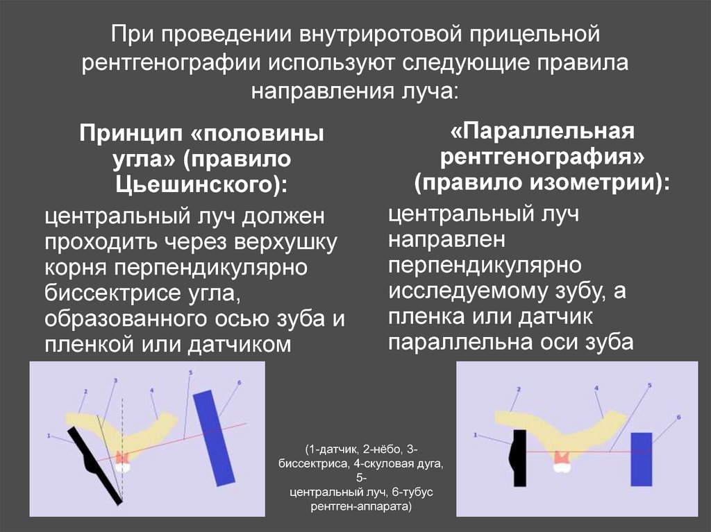 Правило направлений. Порядок проведения рентгенографии. Правило изометрии в стоматологии. Прицельные снимки зубов как правильно делать. Техника выполнения рентгеновских снимков зубов.