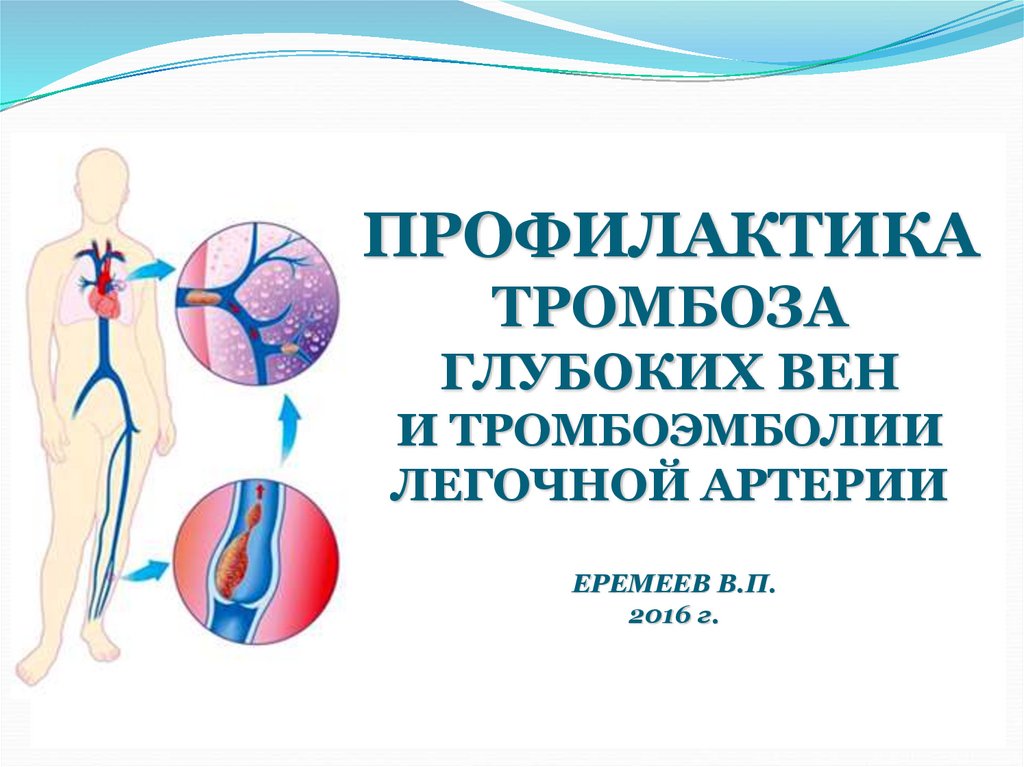 Тромбоз артерии мкб 10. Профилактика венозных тромбозов. Профилактика тромбоза глубоких вен. Профилактика тромбоэмболии, профилактика тромбоза глубоких вен. Профилактика тромбоэмболии глуюоких ве.
