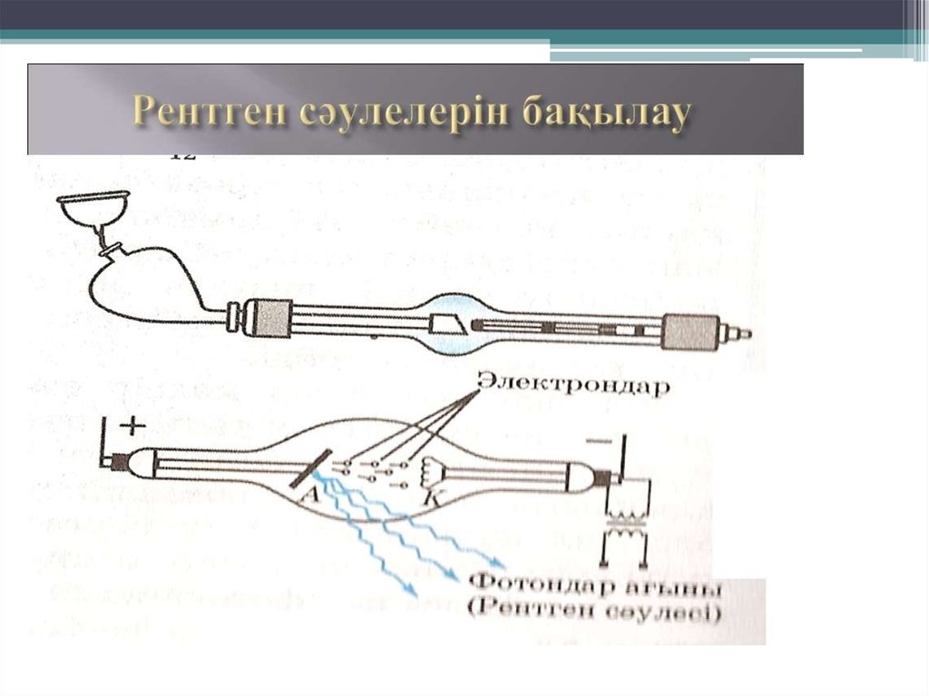 Рентген укладки в картинках и названия для рентгенолаборантов