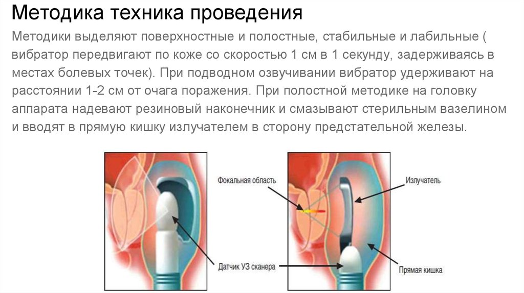 Ультразвуковая терапия презентация