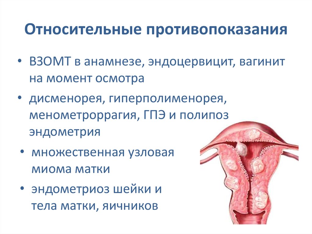 Гипопластическая эндометрия