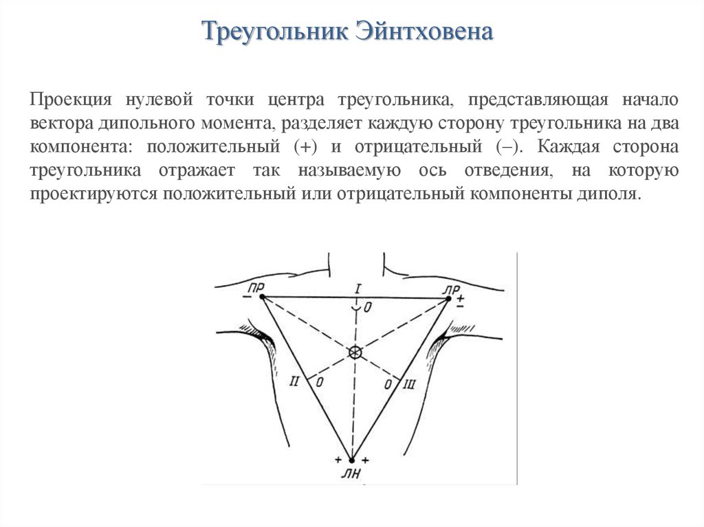 Треугольник Эйнтховена