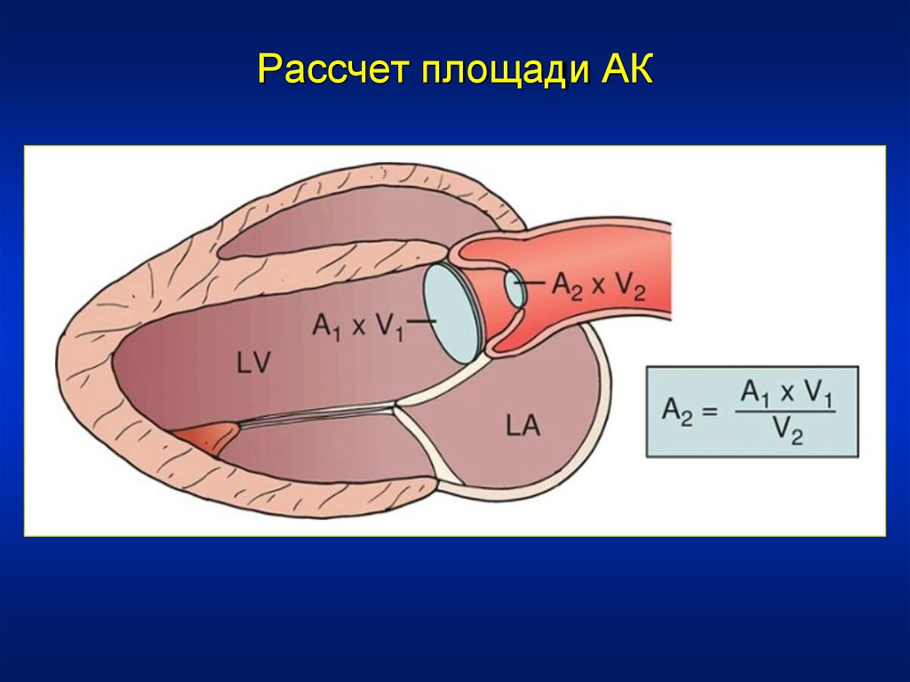 Амплитуда раскрытия аортального клапана